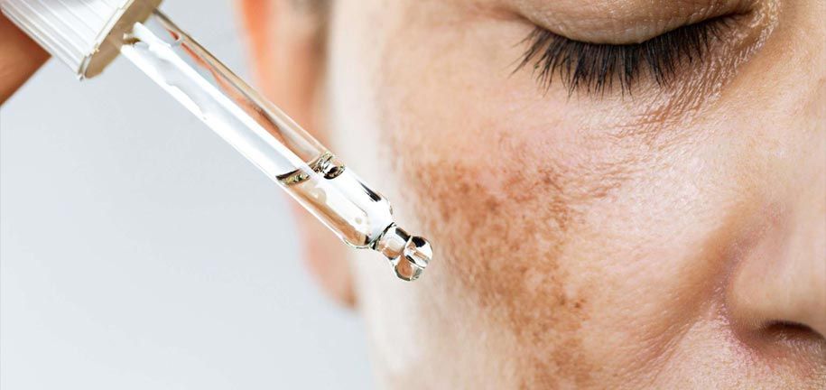 有效治疗色素沉着的方法