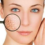 指对干燥和皮肤有刺激性