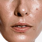 油性皮肤护肤产品